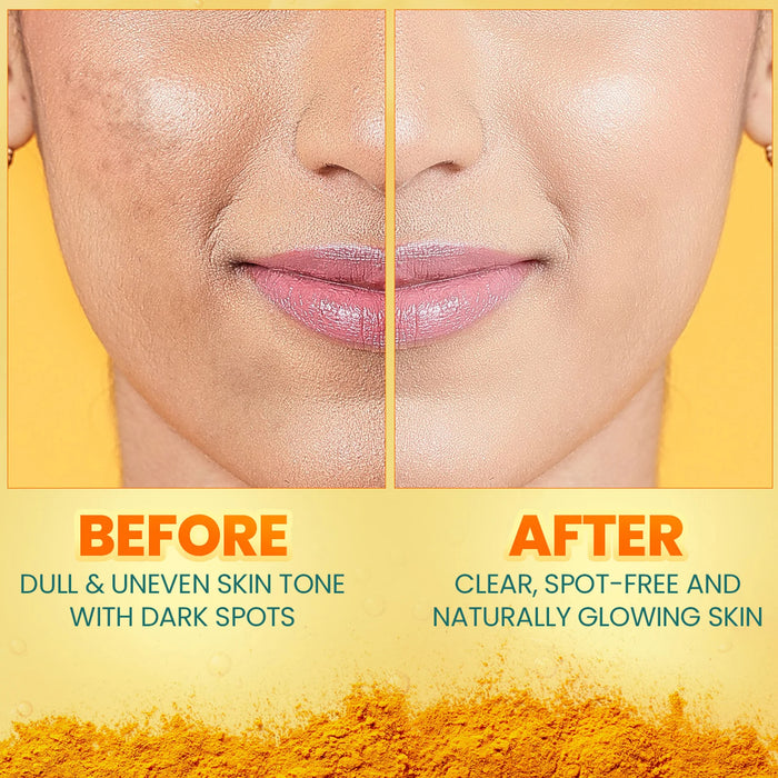 Himalaya Dark Spot Clearing Turmeric Kit