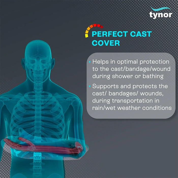 Cast Cover arm Tynor