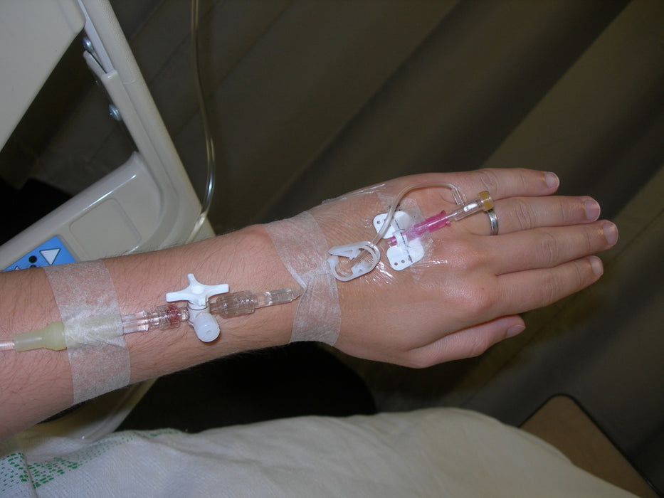 Peripheral IV Catheters