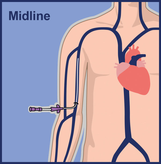 PICC Catheters