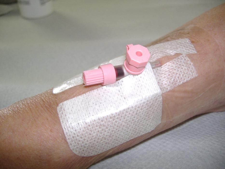 Peripheral IV Catheters