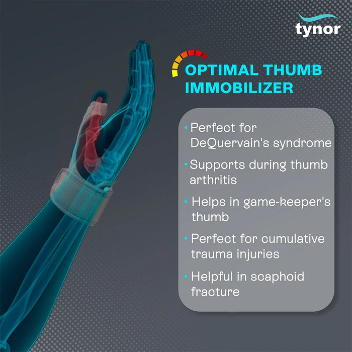 Thumb Spica Splint Tynor